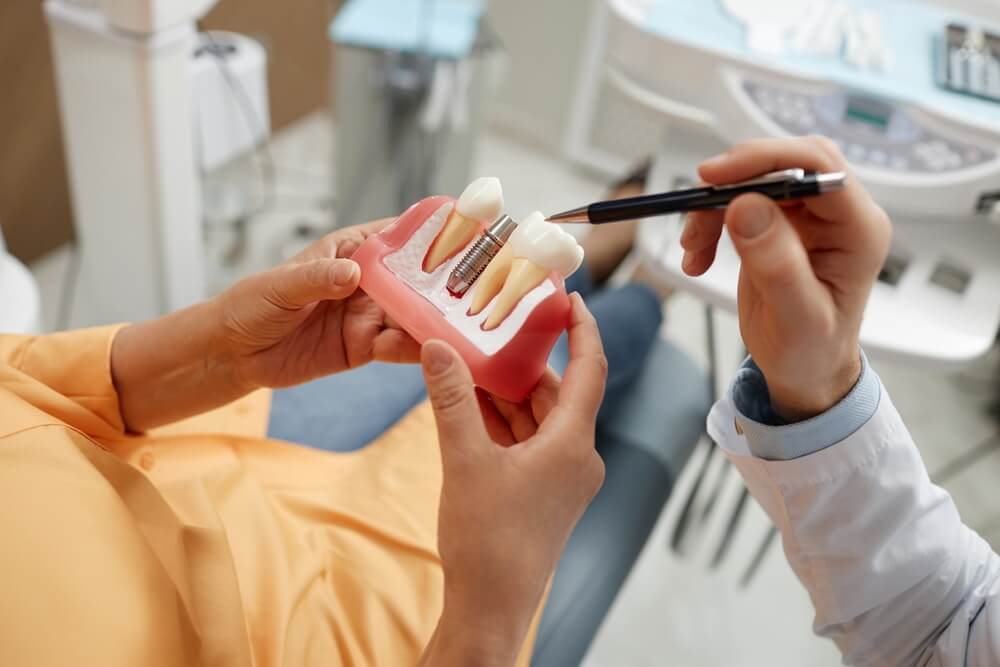 Dental Implants in Newnan, GA